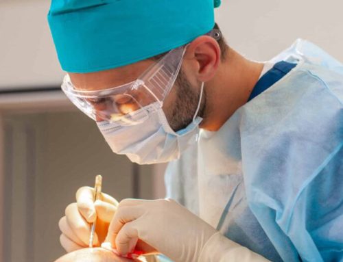 What is the most expensive hair transplant in Turkey?